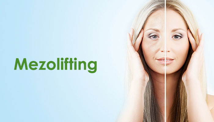 Mezolifting